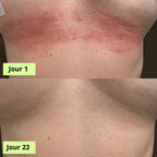 Medvital® Savon Antifongique
