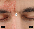 Medvital® Serum Naturel Appaisant