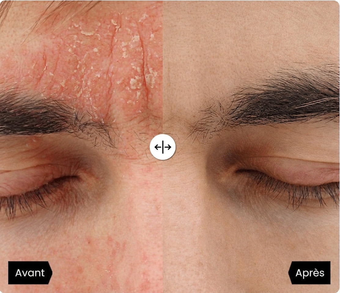 Medvital® Serum Naturel Appaisant