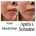 Medvital® Serum Naturel Appaisant