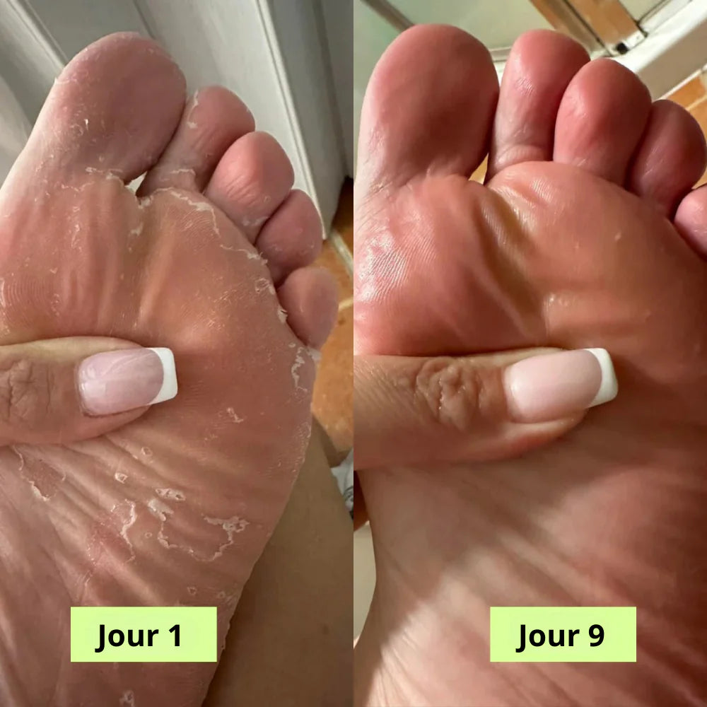 Medvital® Savon Purifiant Antifongique