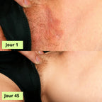Medvital® Savon Antifongique