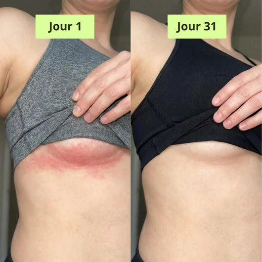 Medvital® Savon Antifongique