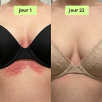 Medvital® Savon Antifongique
