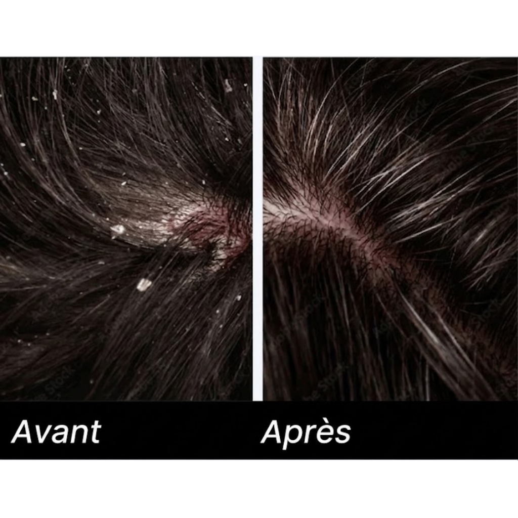 Medvital® Serum Naturel Appaisant
